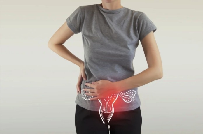 月經失調患者在周期、經期、月經量、月經顏色或質地發生改變,同時亦可伴有腹痛、腹瀉、發熱等症狀。