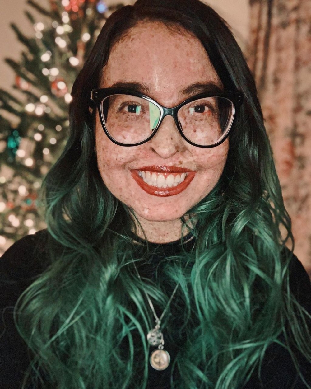 少女Andrea Ivonne Monroy因患有罕見病,令她從未真正享受過陽光。