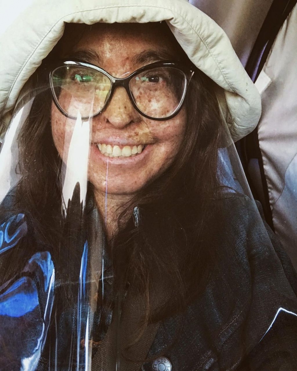 Andrea每次外出都會好好保護自己的皮膚,避免受傷害。