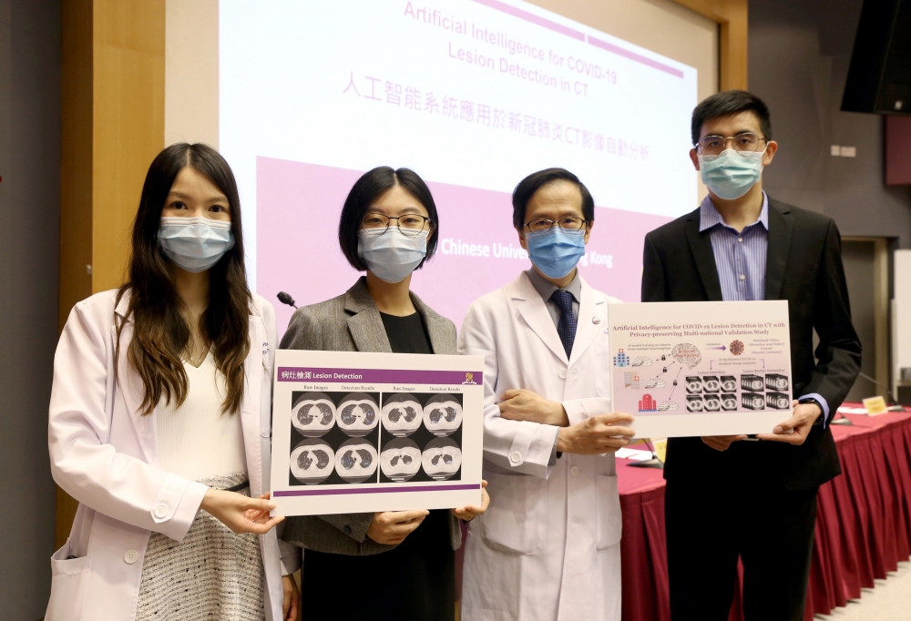 中大醫學院研究團隊研發以人工智能系統(AI)檢測胸部電腦斷層掃描(CT)影像上的新冠肺炎感染徵狀。