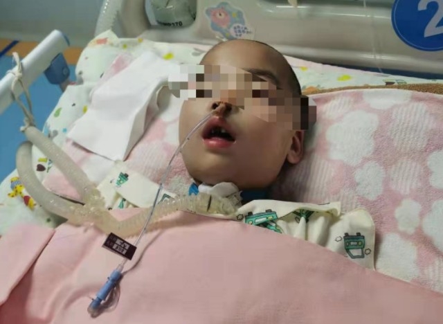 一名男童日前因上頜有多生牙要進行全身麻醉拔牙手術,手術後卻昏迷不醒41日,期間更兩度命危。