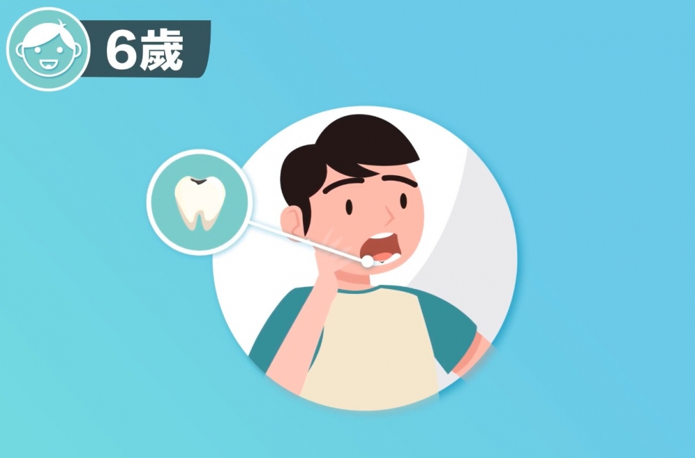 朱教授指,蛀牙不會自行復原,只會一直爛下去,繼而出現痛楚。