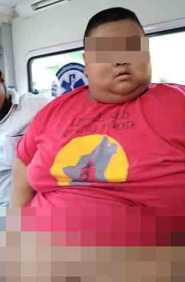 泰國一名13歲男童患有自閉症,出生時體重正常,沒想到短短幾年後體重突破200公斤。