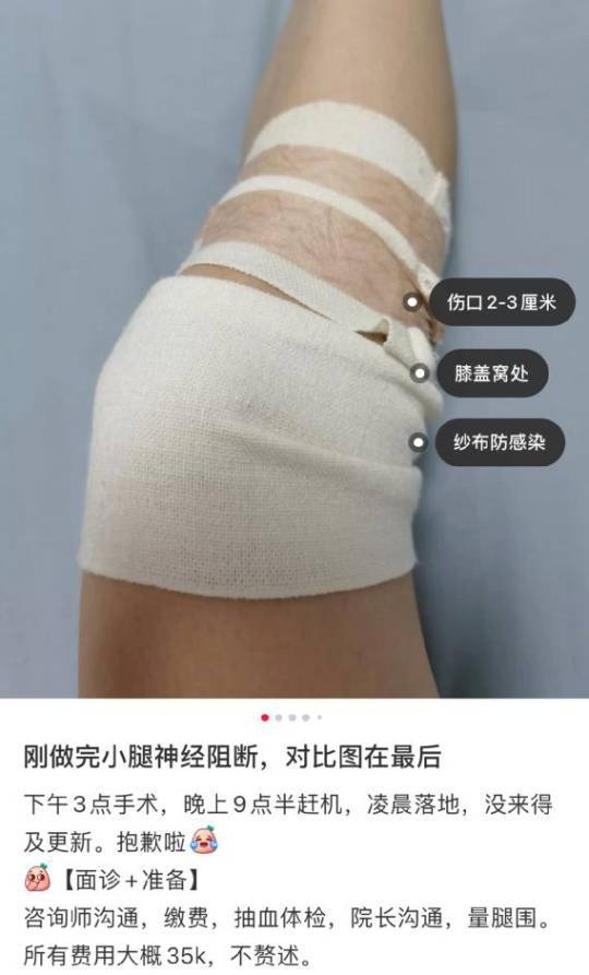 近期內地有女生於社交平台分享一種瘦腿手術「小腿肌肉阻斷術」,聲稱切斷小腿肌肉神經可使肌肉萎縮。