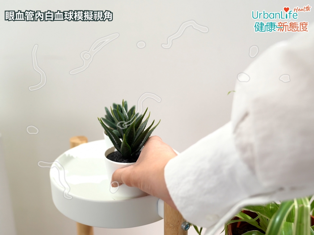 有些飛蚊症患者看見的是，眼睛血管內的白血球影子。