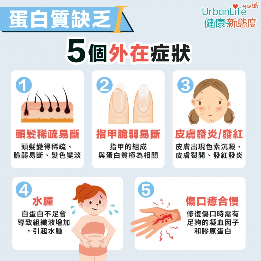 缺乏蛋白質會影響頭髮、指甲、皮膚生成。