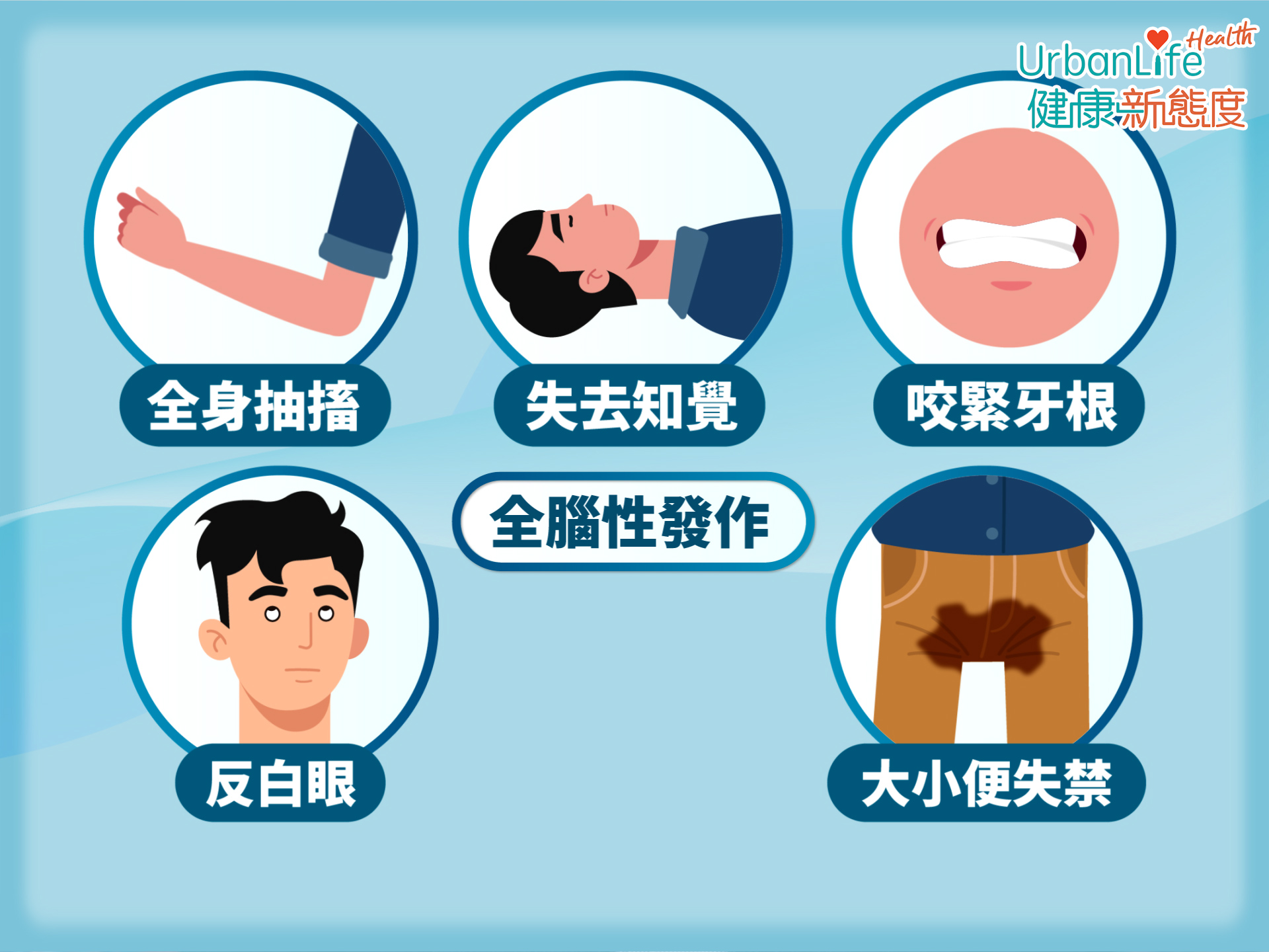 腦部突然間全部都有不正常腦電波出現,又稱為「大發作」。