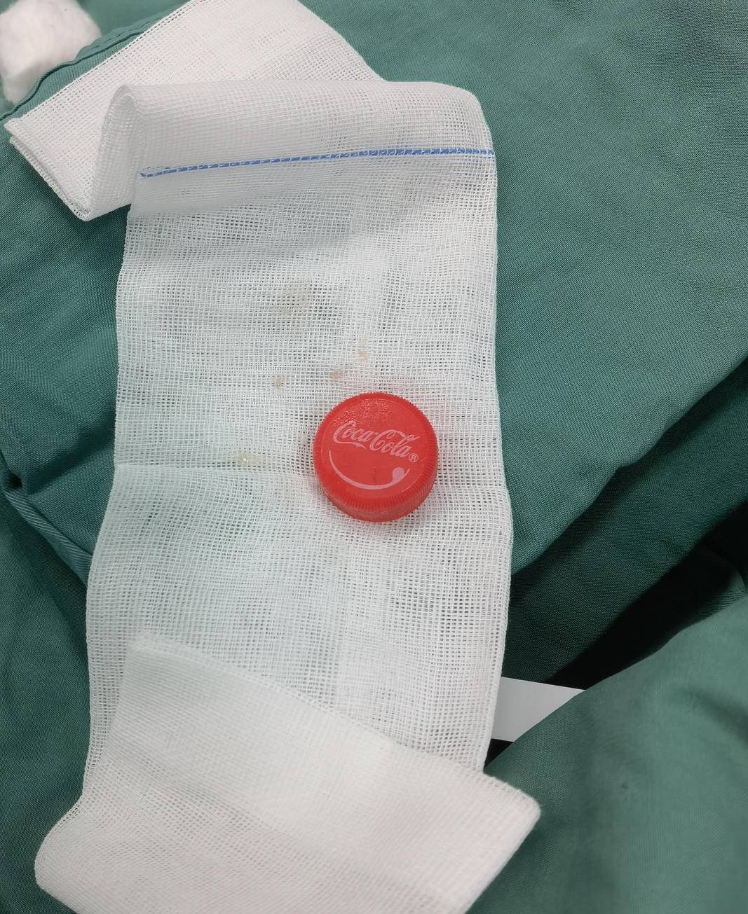 經過12分鐘的手術才成功將瓶蓋拉出。