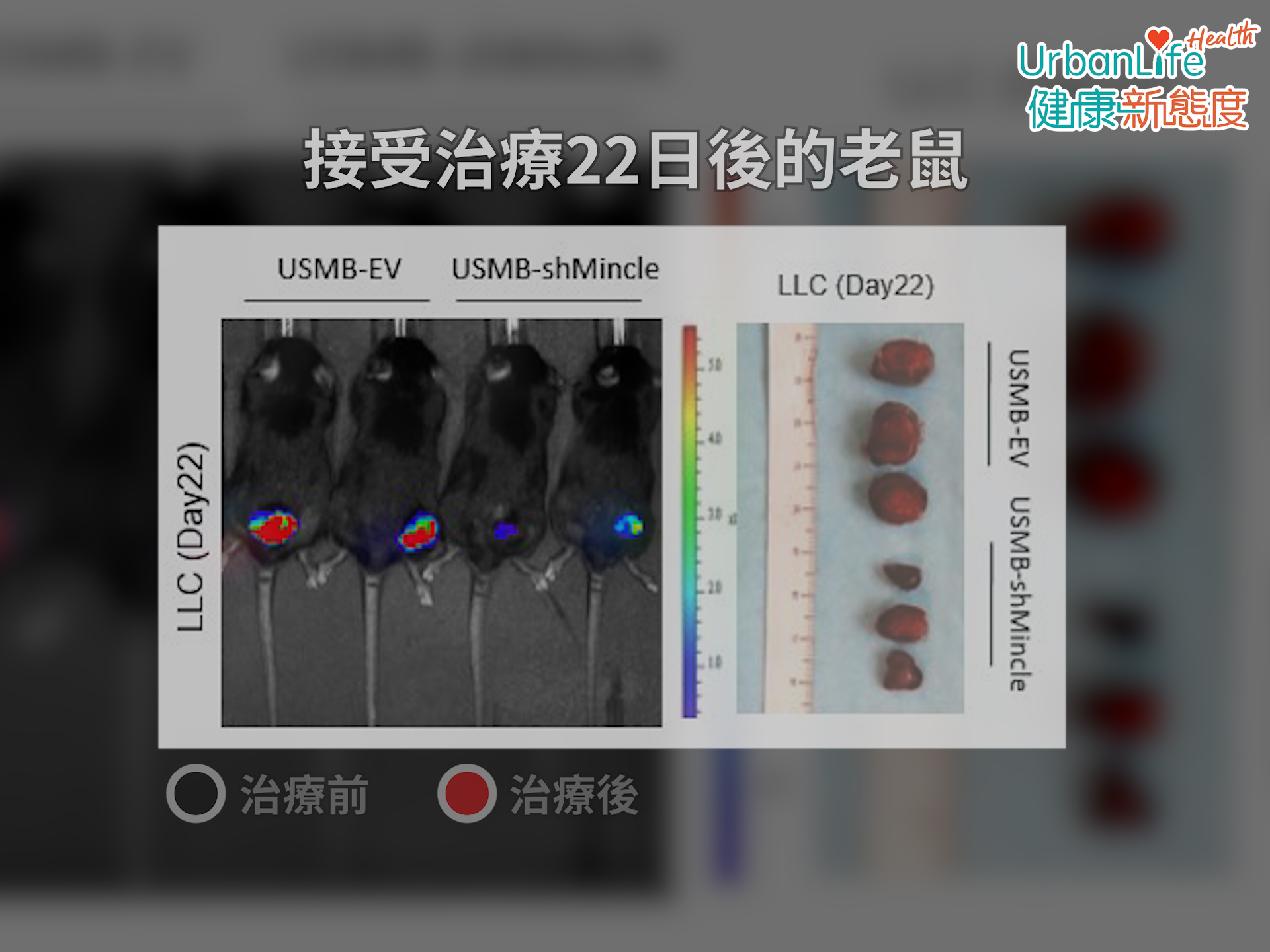 該無病毒基因治療不但不會破壞受試動物的重要器官,而且在動物模型中能有效降低腫瘤生長,腫瘤最少縮小七成。