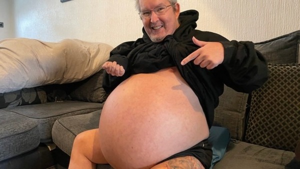 英國一名54男子有一個如懷孕的巨肚,原來他患有多囊性腎病變。
