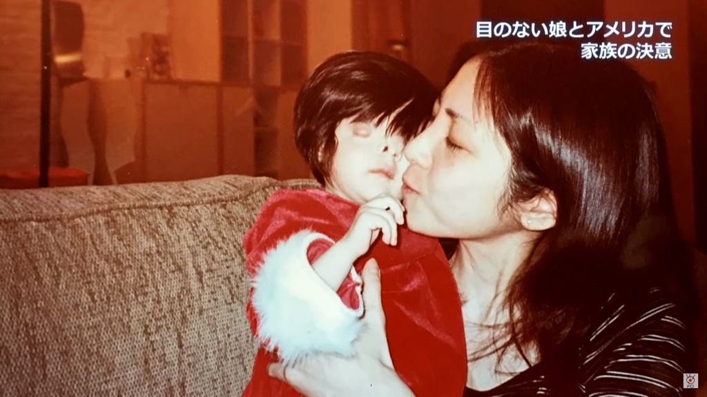 美香表示「第一次看到女兒的時候,她躺在新生兒重症監護室裏,雖然沒有眼睛,鼻子有個大洞、額頭有些歪,但我覺得她很可愛」。