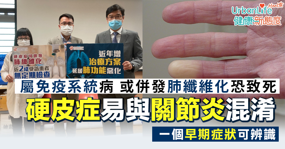 【硬皮症症狀】可併發肺纖維化 易與關節炎混淆一個症狀可辨識