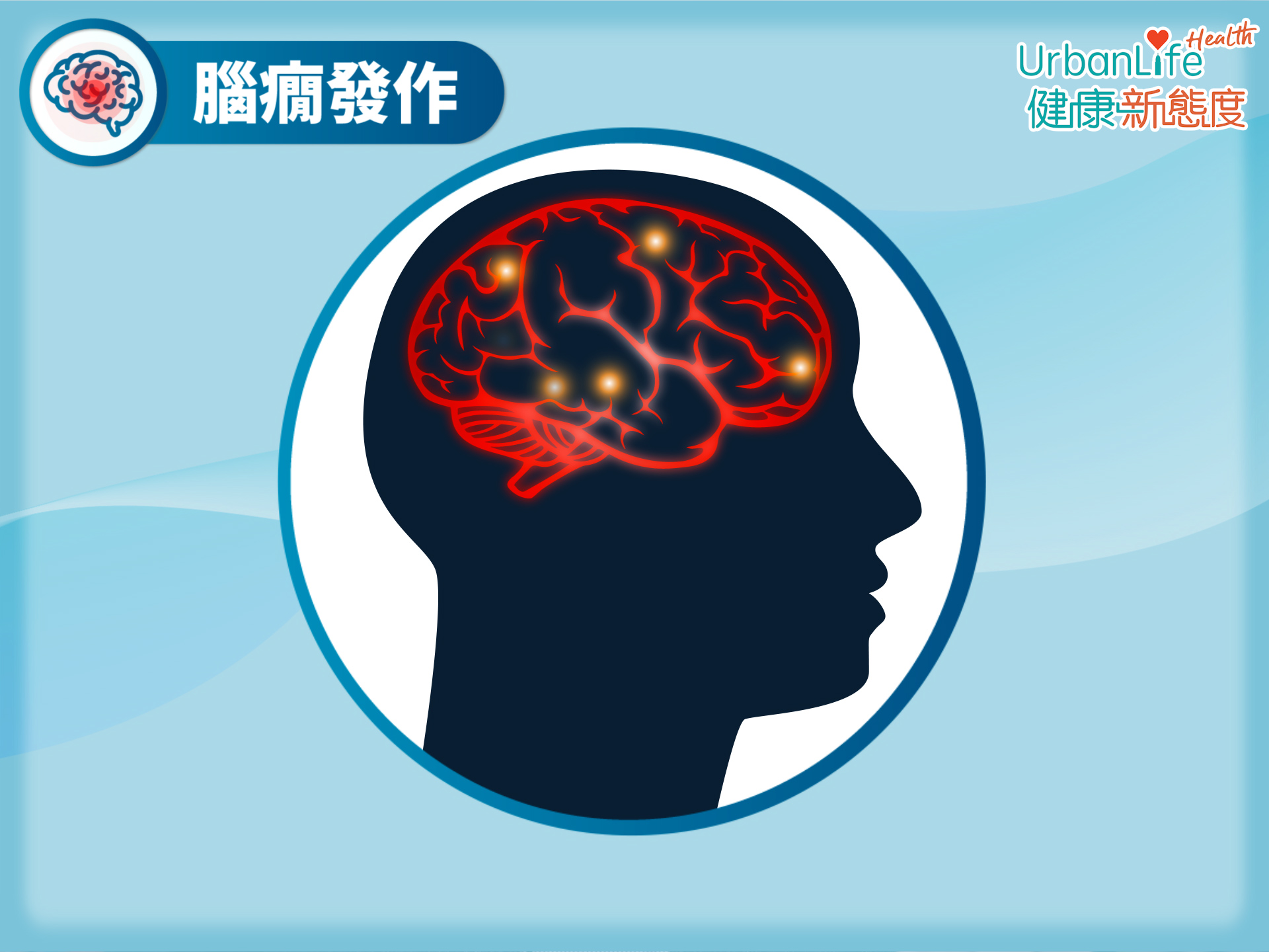 根據2007年一個調查推算,本港每1000人當中,就有4人患有腦癇症。