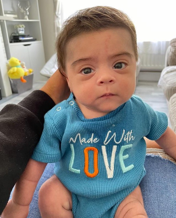 北愛爾蘭一名3個月大男嬰,因剛出生已有一頭濃密秀髮在網上爆紅。