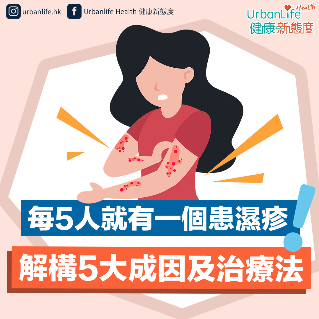 要紓緩濕疹問題,即了解5大濕疹成因及6個護理對策。