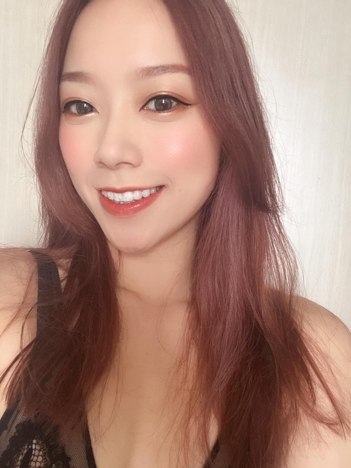 矯齒療程應由註冊牙醫評估和量身訂造