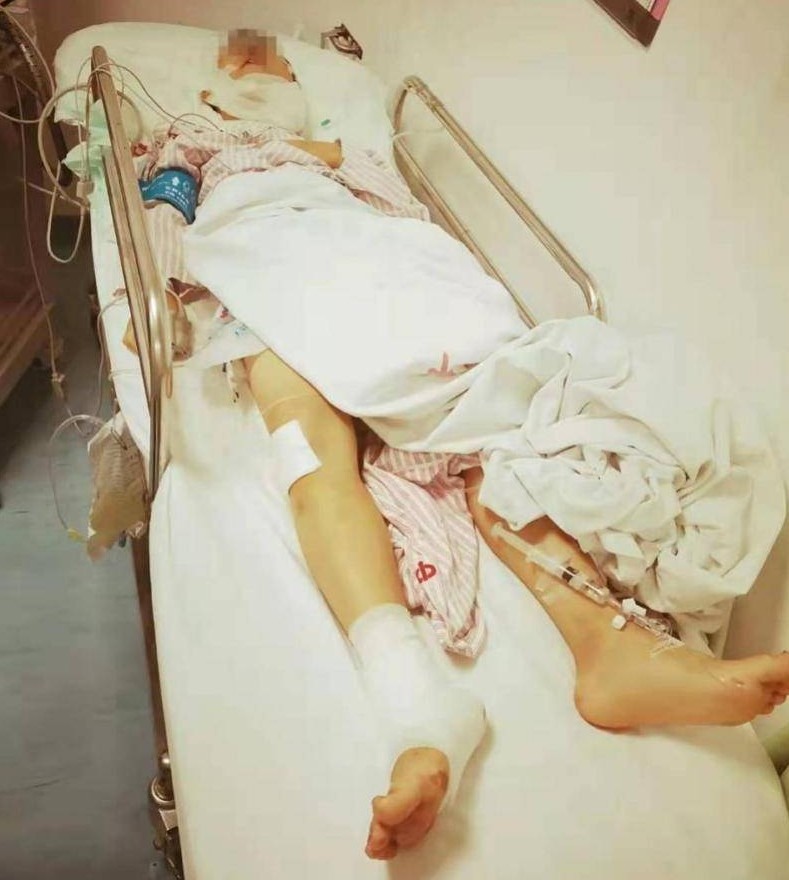 小翁當時至少出血2,000毫升,相當於身體一半血量。