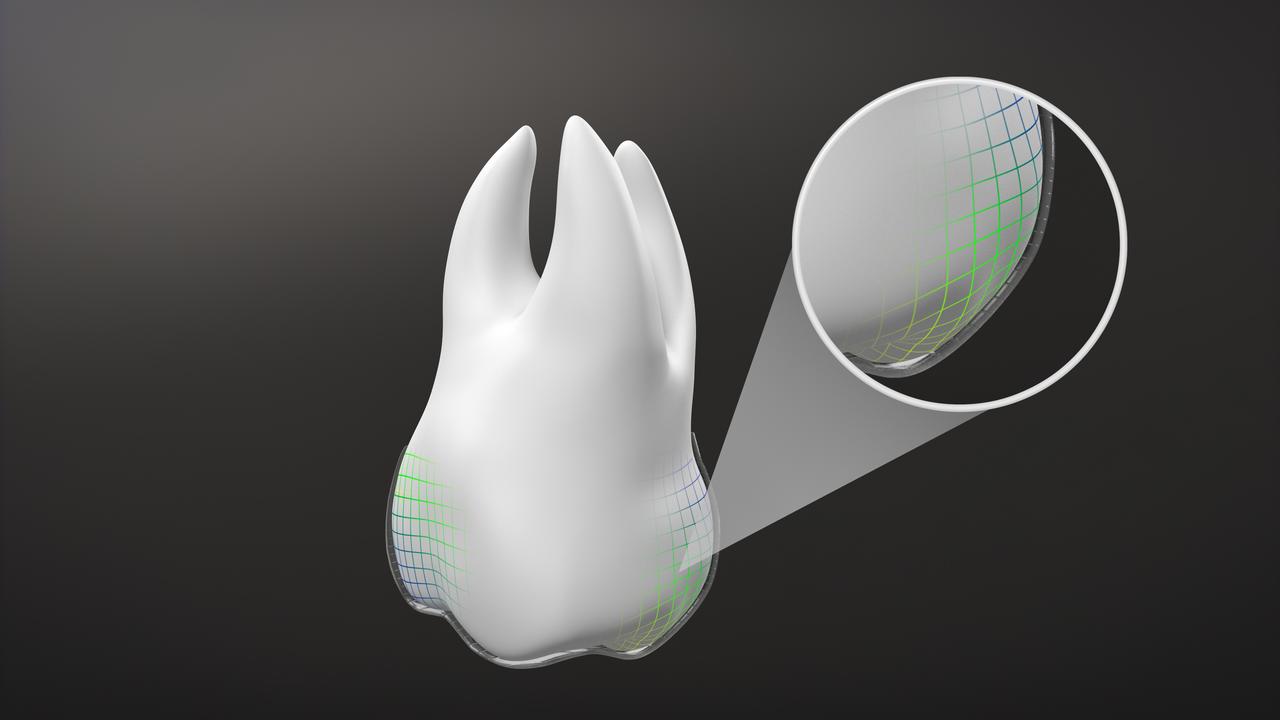 以藍色凝膠測試牙箍緊貼度