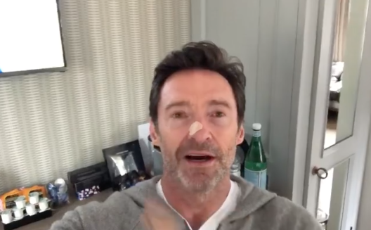 Hugh Jackman近日上載一段影片,片中他的鼻上貼有膠布,他透露自己剛完成活體組織切片檢查。