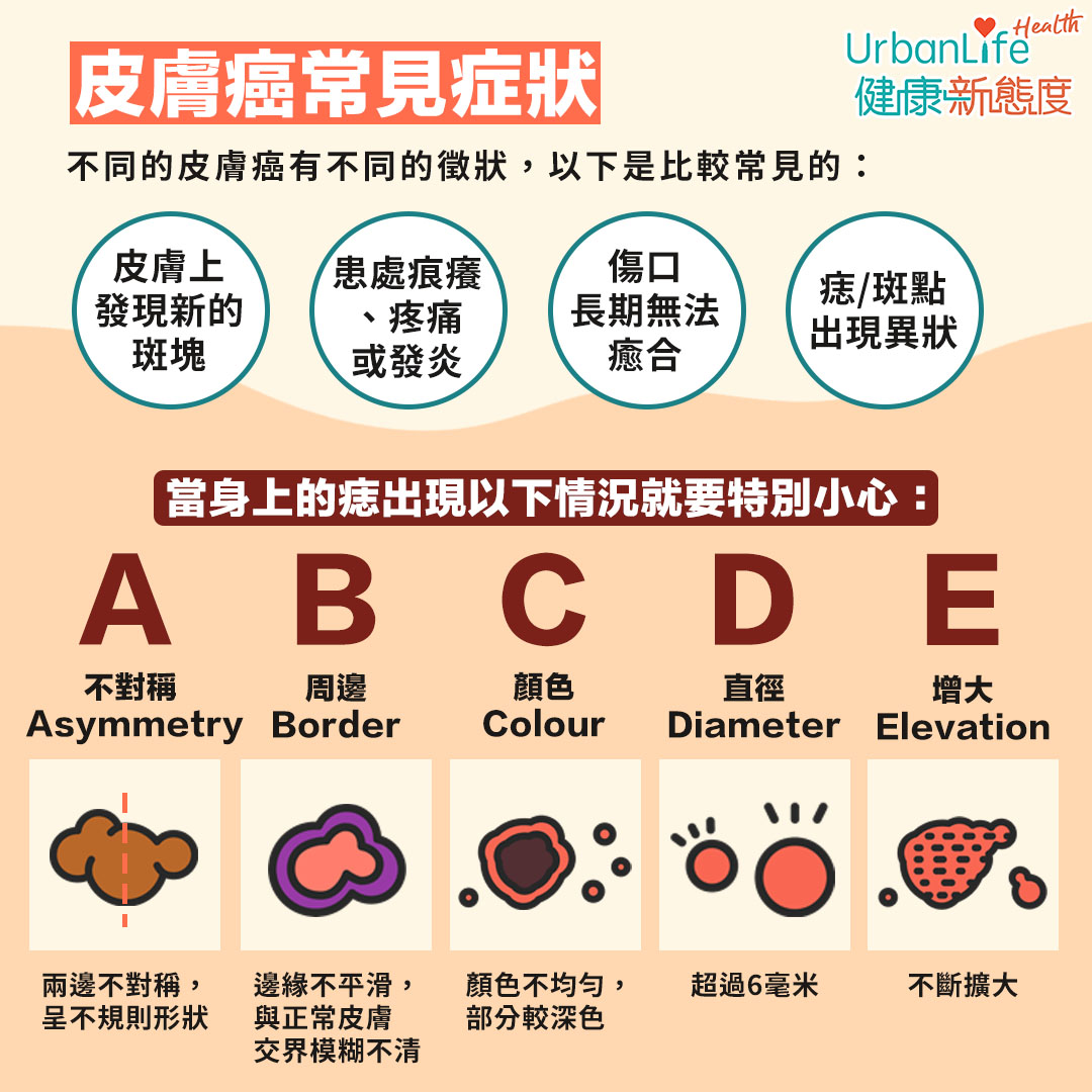 皮膚癌常見症狀