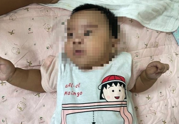 台灣一名3個月大的女嬰,轉喝配方奶粉後,由原本一日排3次便,暴增至每日8至10次,嚴重更曾1日排15次大便,甚至大便中有血絲。求診後,才發現女嬰是對牛奶蛋白過敏。