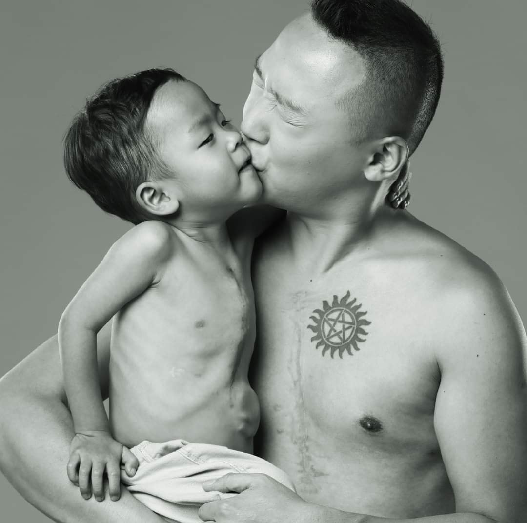 小鐵漢患有先天性心臟病,出生至今已經歷5次手術,並正排期接受最後一個心臟大手術