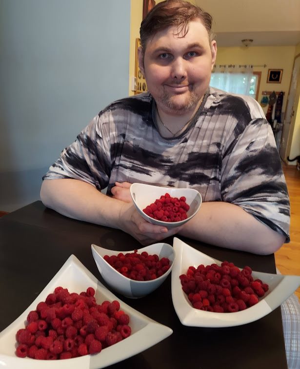 Igor Vovkovinskiy亦曾因腳尺碼太大,而在6年間做過16次縮腳手術。