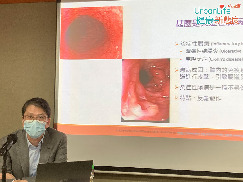 腸胃肝臟科專科醫生梁偉強表示,潰瘍性結腸炎病因為體內免疫系統失衡,對消化道進行攻擊,引致腸道發炎及潰爛。