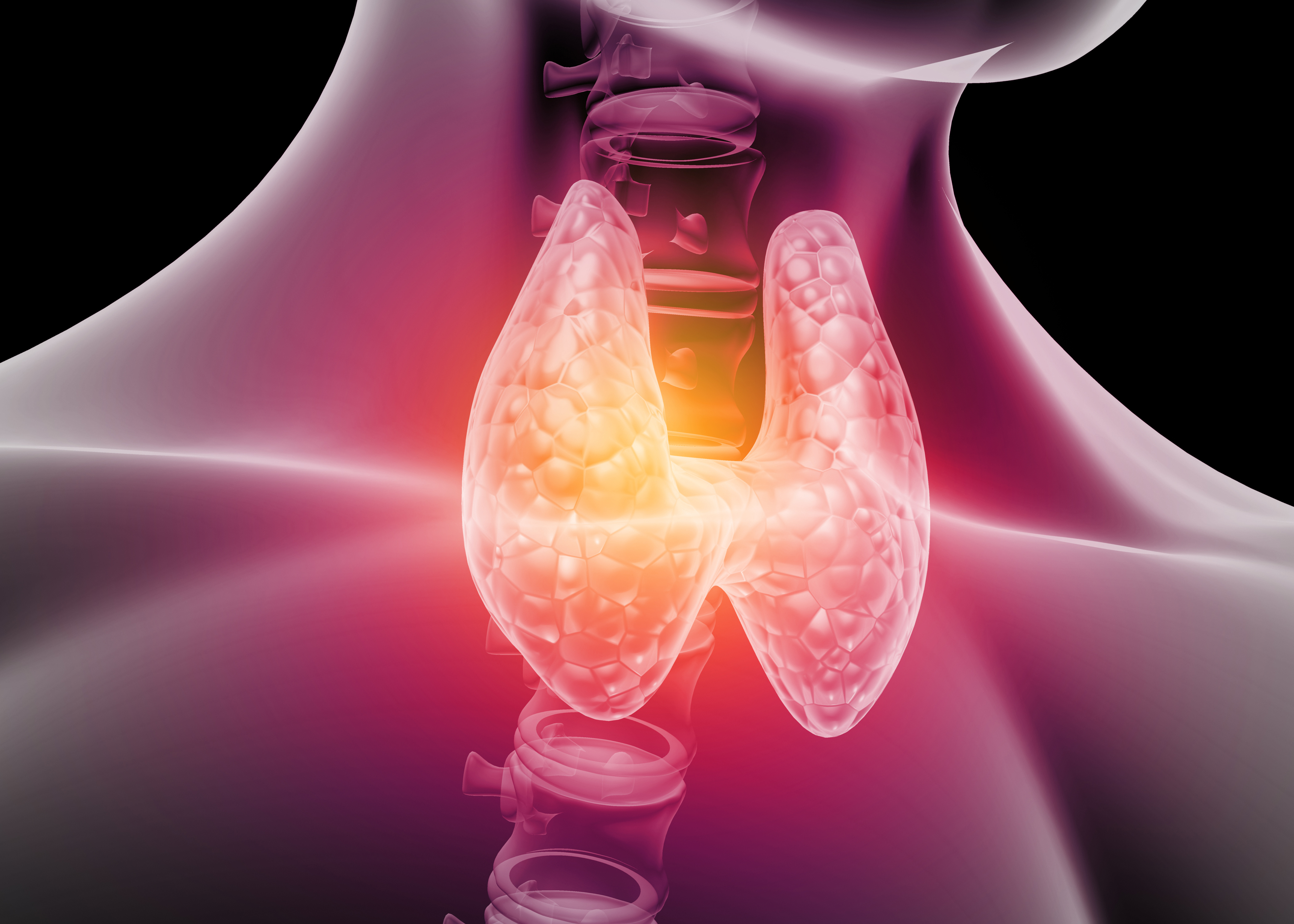 甲狀腺癌(Thyroid Carcinoma)是最常見的甲狀腺惡性腫瘤,約佔全身惡性腫瘤的1%,女性比男性發病率高,男女發病率比例為1:4。