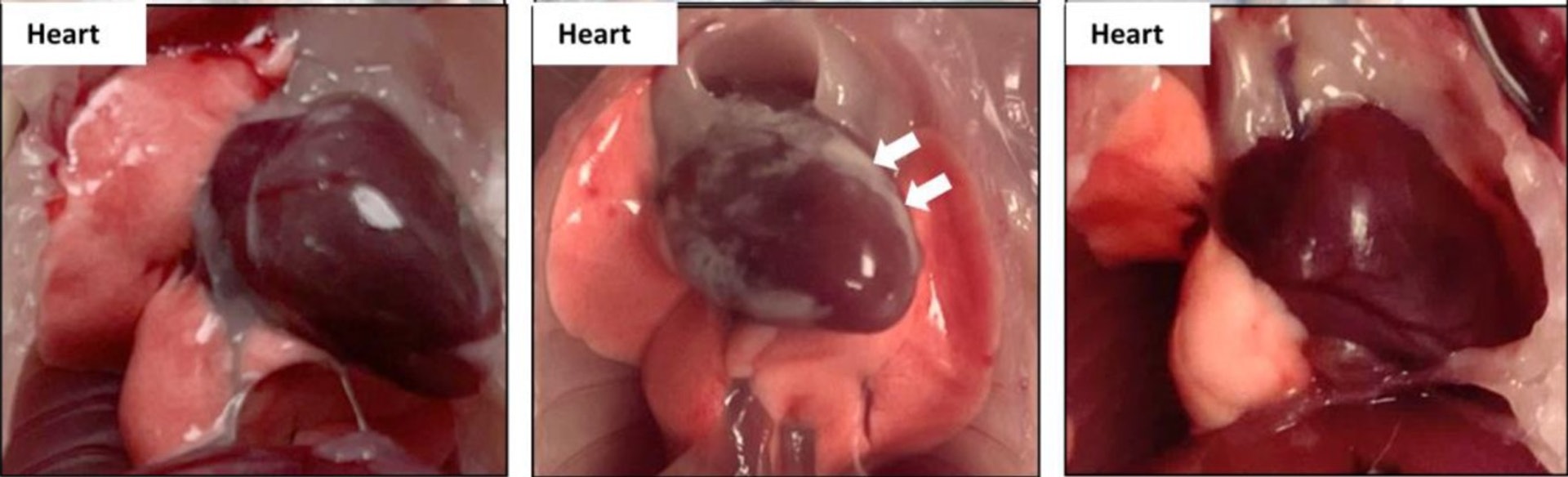 中間的小鼠心臟是以靜脈注射復必泰疫苗出現心包炎,即心包白斑(鈣化)。