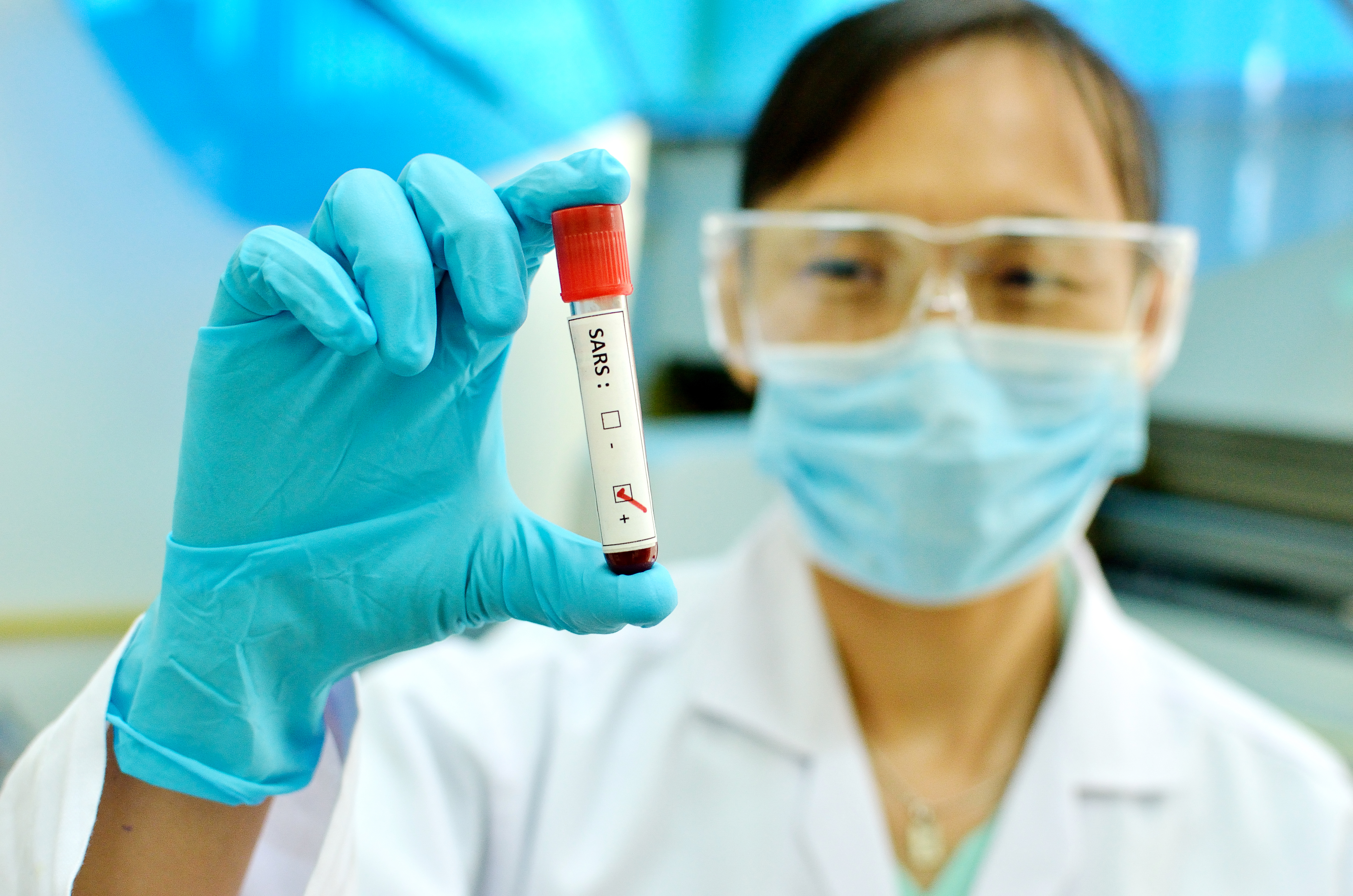 SARS康復者擁有一群B細胞，它們能夠識別 SARS-CoV 和SARS-CoV-2，但數量很少且難以看到。他又認為，新冠疫苗可能會增強這些雙作用B細胞的數量，並擴大康復者的免疫力。