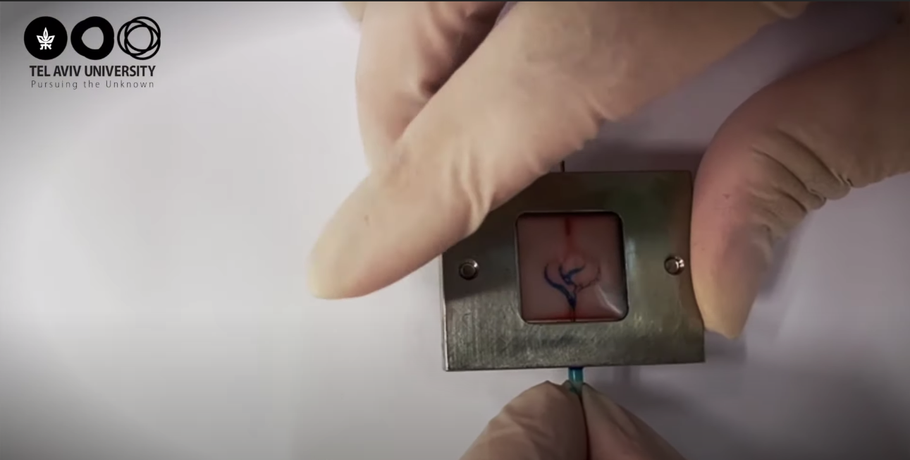 3D打印可精細至製作到血管。