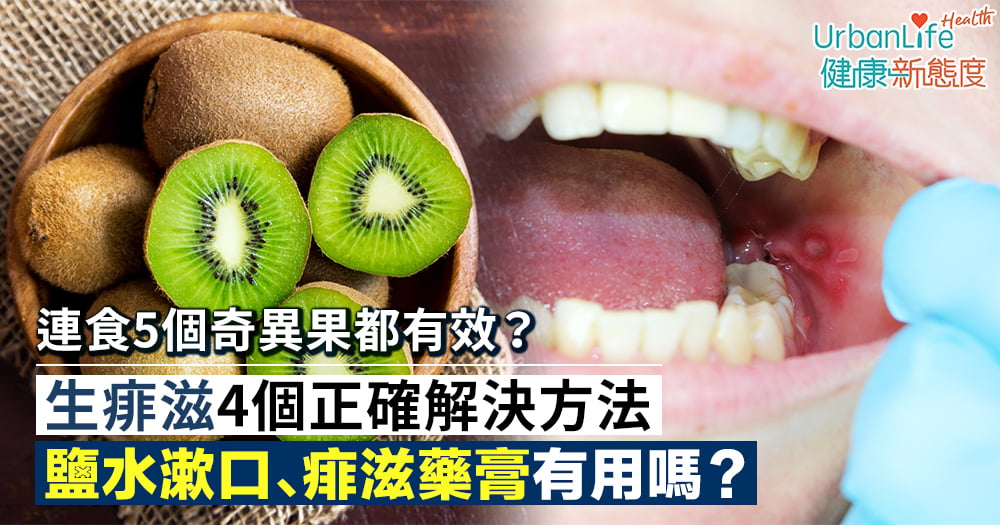 【痱滋解決】4個生痱滋快好方法!痱滋膏、連食5個奇異果有用嗎?