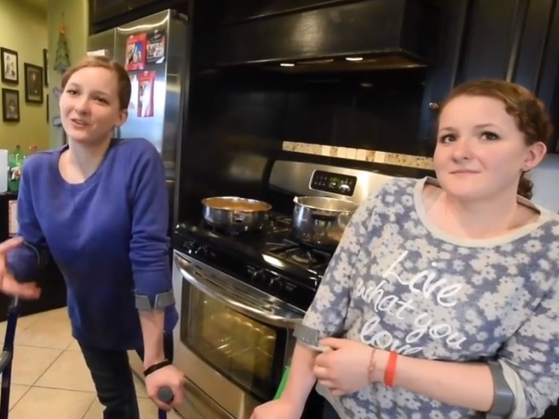 醫護團隊順利令兩姊妹以獨立個體示人,往後亦需努力適應只有一隻腳的生活。