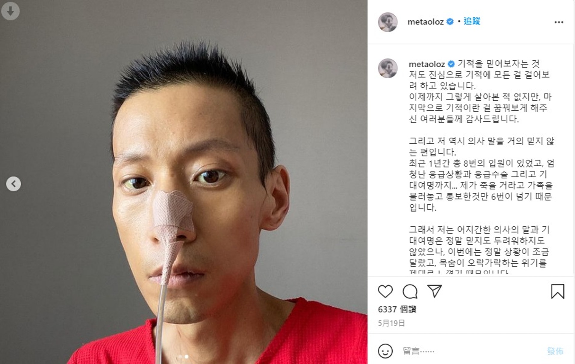 權順旭曾於社交平台插喉的相片,表示自己因為腸梗塞而致兩個月無法進食,體重暴跌至36公斤,需吊鹽水維生。