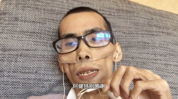 今年起阿健明顯開始由健壯的身體變得皮包骨和有氣無力,最後一次更新影片時,臉頰更變得凹陷,連聲音也發不出來。