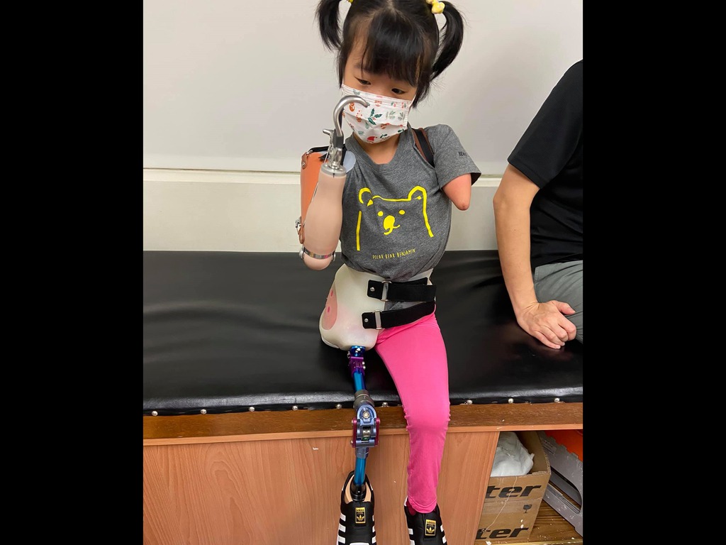 又立從小就需要捱過一連串的復康訓練,學習單腳站立,學習自理。儘管面對重重難關,又立仍樂觀面對人生,更被人稱為「單腳天使」。