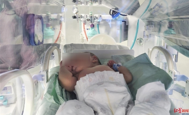 幸好，在男嬰住院治療的第3天，情況逐漸好轉。