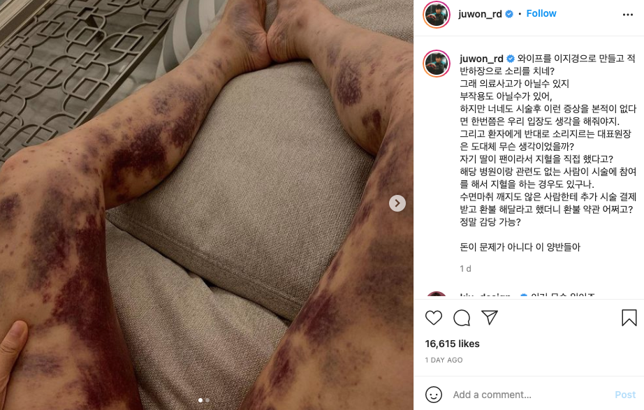 丈夫徐柱原對此事感到憤怒,因涉事醫院以非常消極態度處理事件。