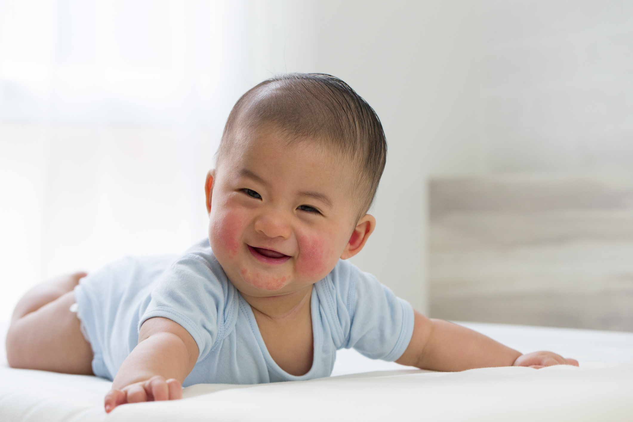 BB出風癩原因多因免疫系統未成熟發展所致,當身體與病菌對抗時,或受敏感源刺激而發生過敏反應,風癩就會出現。