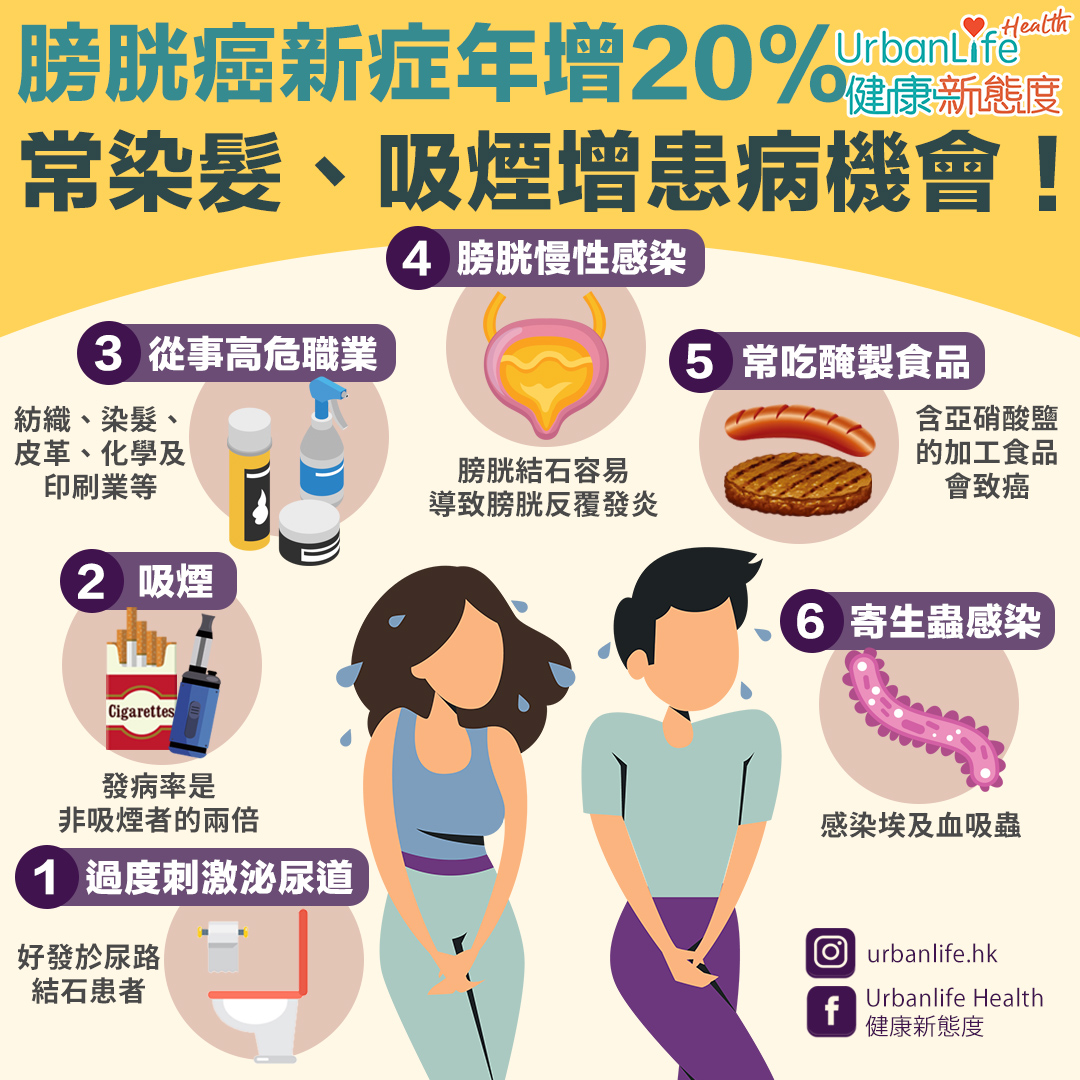 膀胱癌的成因至今仍然不明,但或與吸煙有關。