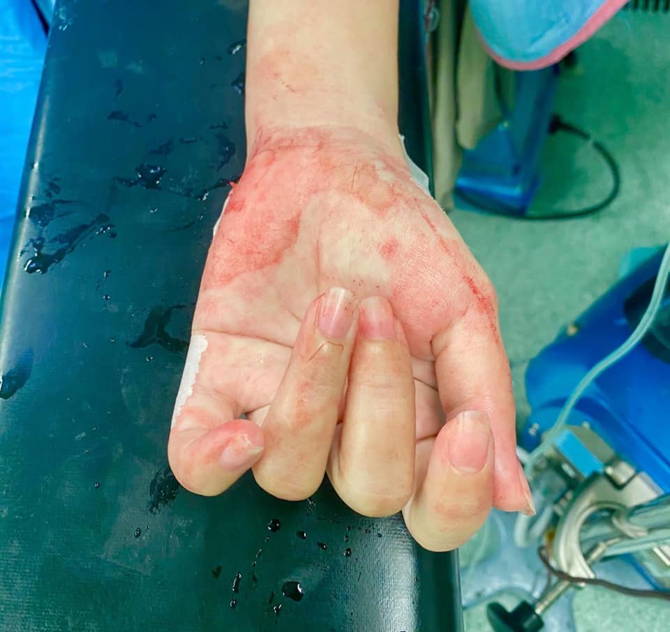 在場醫生憶述,產婦剛到急診的時候整個被子都是血。