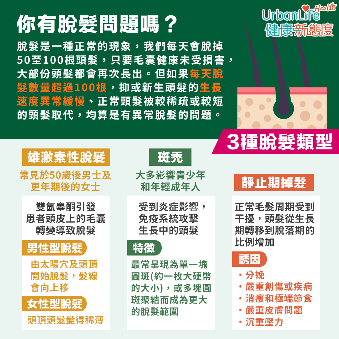 脫髮主要分為3個類型。