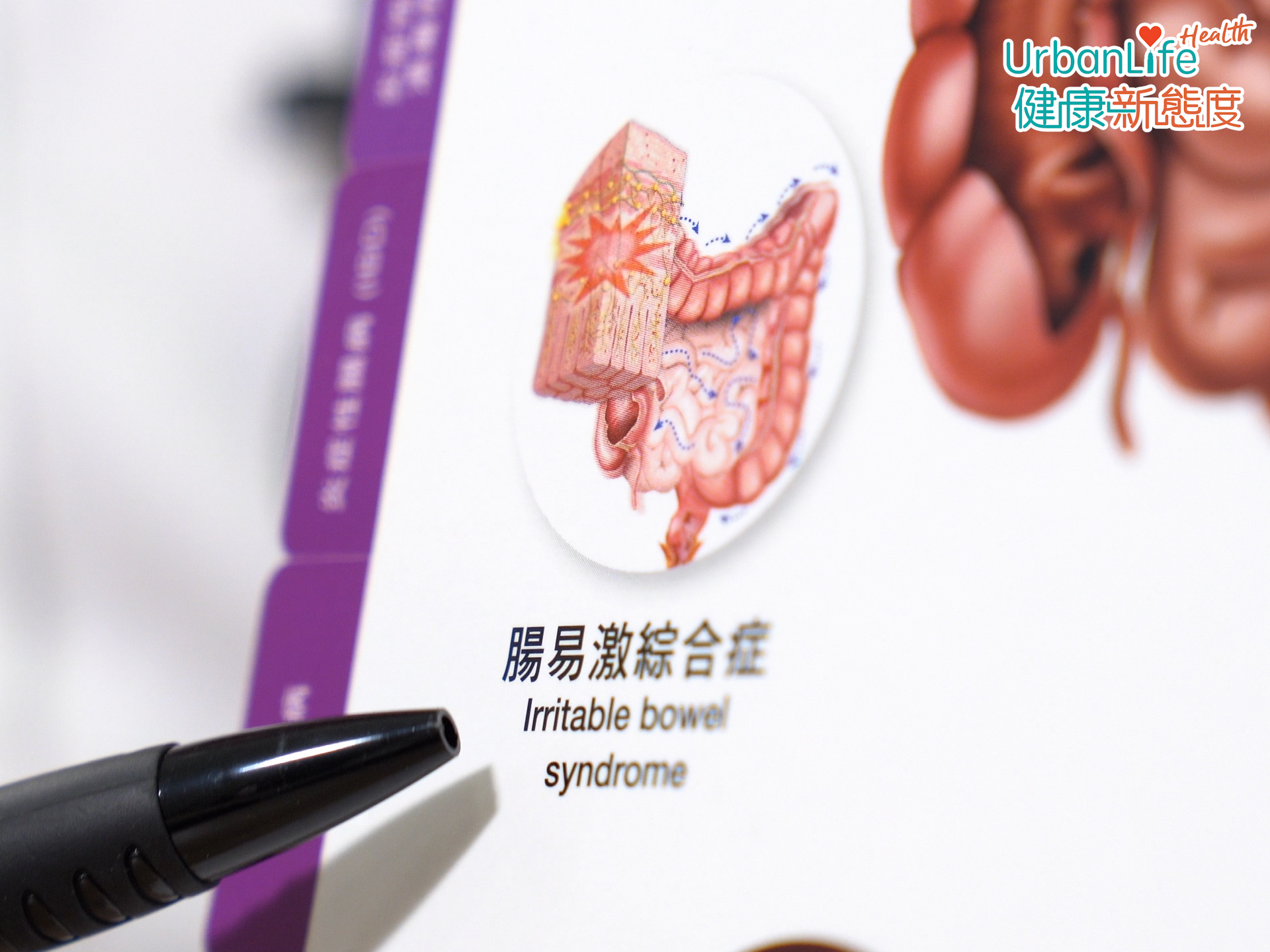 經常出現肚痛、肚瀉的情況,緊張、壓力大尤其嚴重?小心可能是患腸易激綜合症!