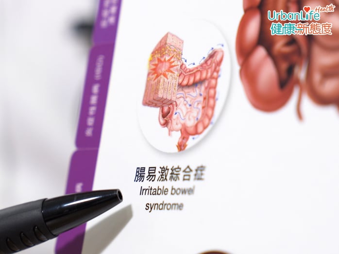 經常出現肚痛、肚瀉的情況,緊張、壓力大尤其嚴重?小心可能是患腸易激綜合症!
