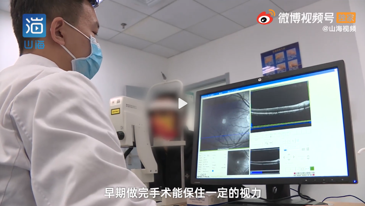 醫生指,若拖到黃斑區再做手術,視力就會很差。