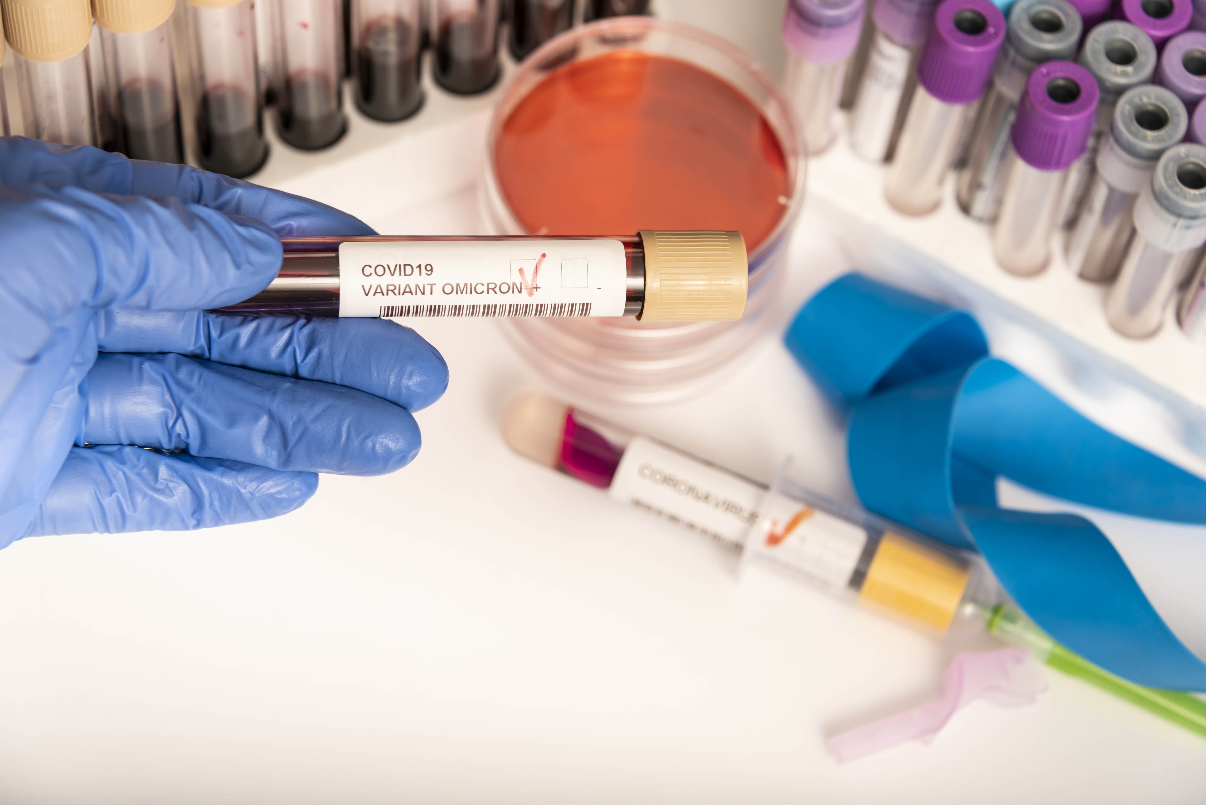 世衛早前將來自非洲的新變種病毒株「B.1.1.529」命名為「Omicron」。