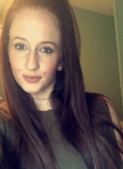 女子染髮後頭部起水泡及結痂