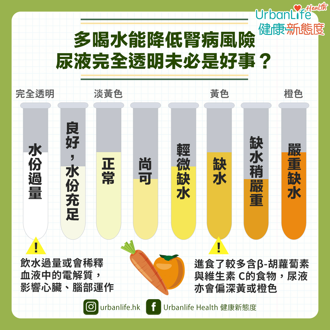 尿液顏色愈深,代表尿液濃度愈高。