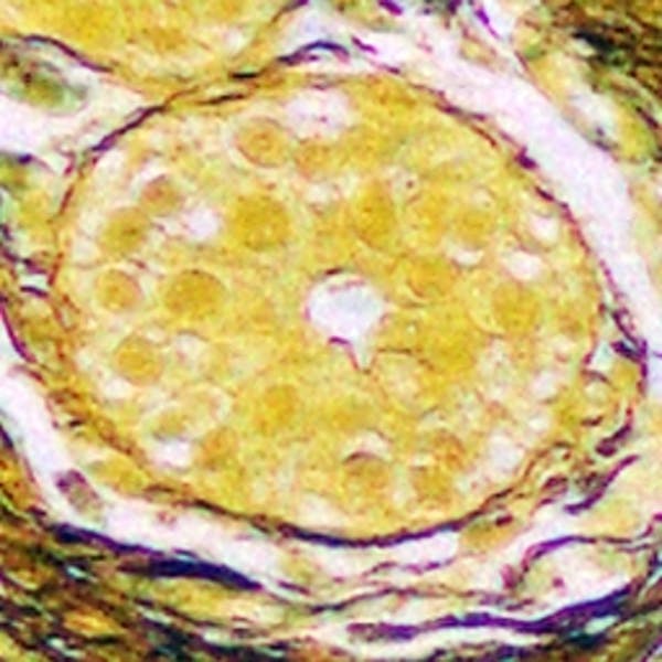 以乳房細胞為例,正常細胞穿過納米塗層後是黃色。